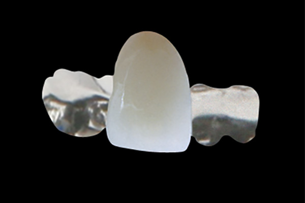 Maryland Bridge (CoCr)